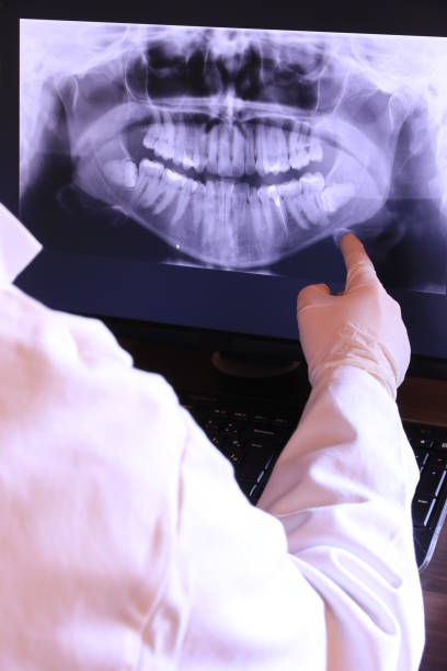 Best Emergency Wisdom Teeth Removal in Burns, TN