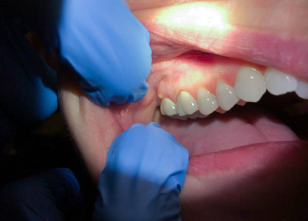 Best Emergency Broken Tooth Repair in Burns, TN