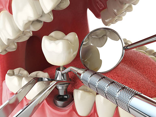 Best Emergency Treatment for Toothache in Burns, TN